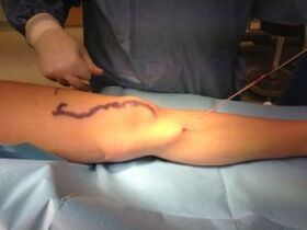 chirurgie